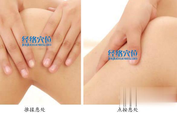 艾灸治療風(fēng)濕