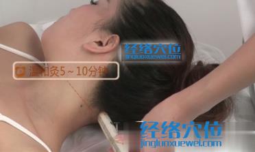 艾灸風(fēng)池穴