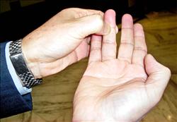 手指肺穴位位置圖