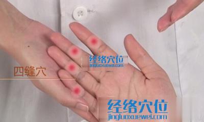 四縫穴位位置圖