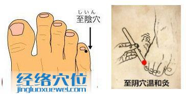 艾灸至陰穴及其位置圖