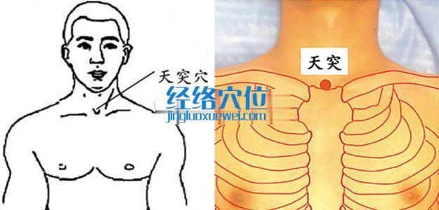 天突穴的準(zhǔn)確位置圖