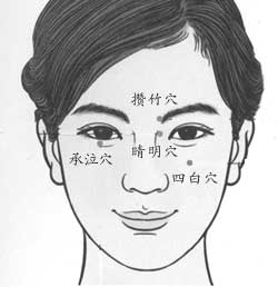 睛明穴位圖