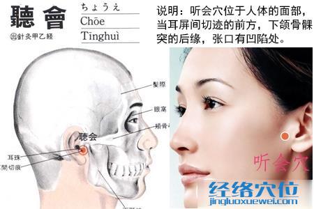 聽會穴位圖