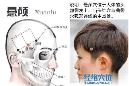 懸顱穴的位置圖