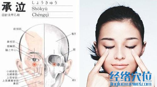 承泣穴的準(zhǔn)確位置圖