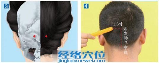 玉枕穴位位置圖