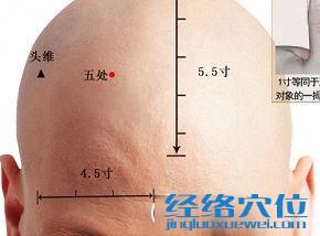 五處穴的準(zhǔn)確位置圖