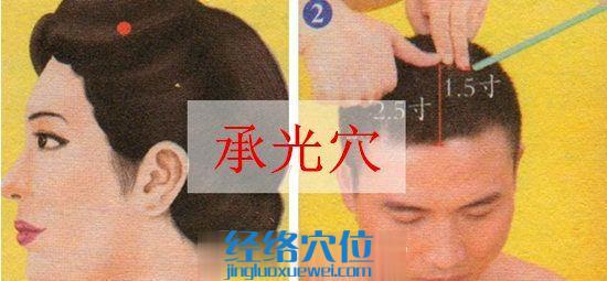 承光穴位位置圖
