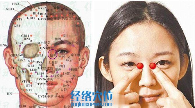 睛明穴的位置及解剖分析圖