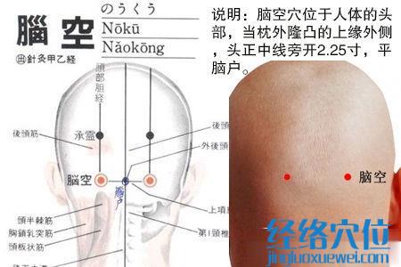 腦空穴