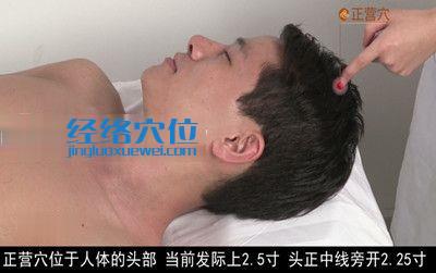 正營穴位位置圖