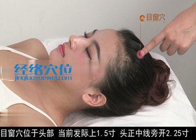 目窗穴位位置圖