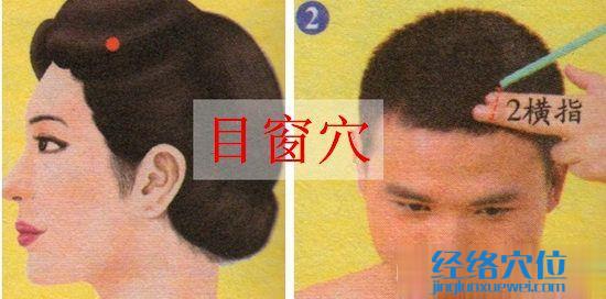 目窗穴的取穴方法示范圖