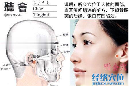 聽(tīng)會(huì)穴位位置圖