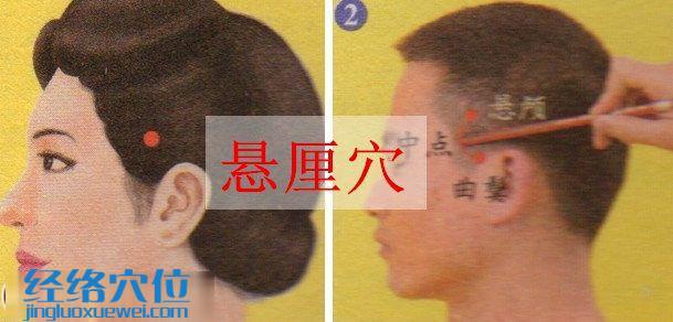懸厘穴的位置圖