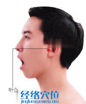 聽(tīng)會(huì)穴位位置圖