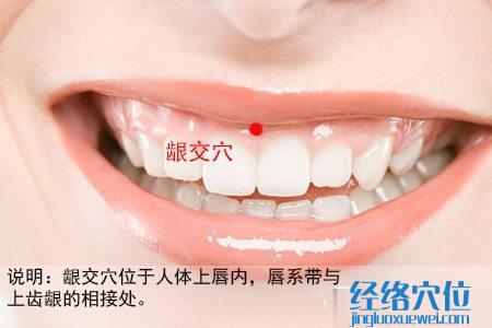 齦交穴