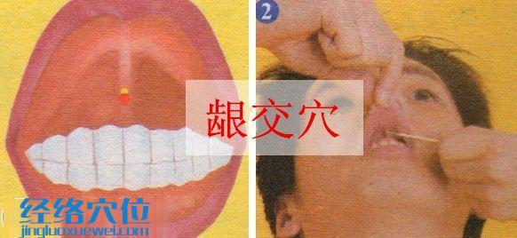 齦交穴的準(zhǔn)確位置