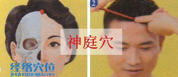 神庭穴位位置圖