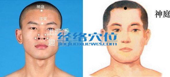 神庭穴的準(zhǔn)確位置圖