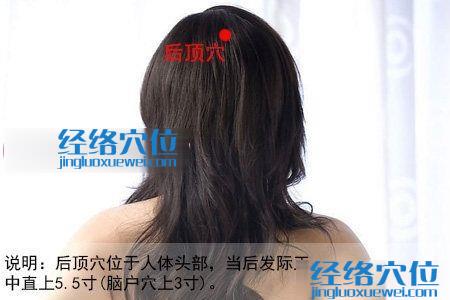 后頂穴位位置圖