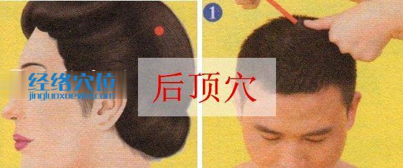 后頂穴的位置圖