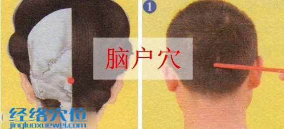 腦戶穴的位置圖