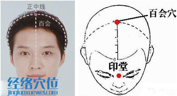 圖解百會(huì)穴的準(zhǔn)確位置圖