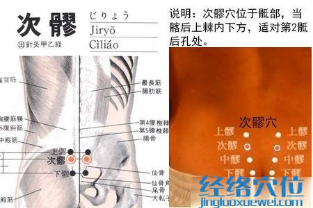 次髎穴位位置圖