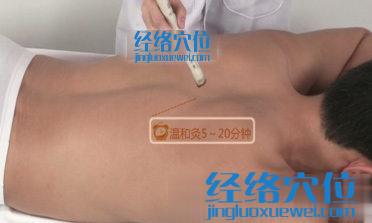 艾灸心俞穴的示意圖