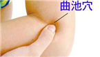 針灸曲池等穴位|治療蕁麻疹、皮膚劃痕瘙癢[風(fēng)疹]