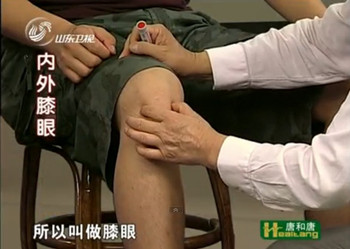 內(nèi)膝眼、外膝眼治療膝關(guān)節(jié)疼痛、酸、以及骨刺的形成、膝關(guān)節(jié)積水