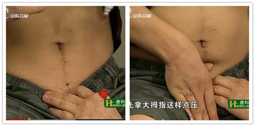 治療痛經(jīng)的主體首要穴位：關元穴