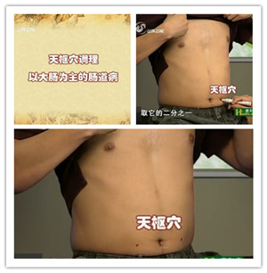 天樞穴位位置圖