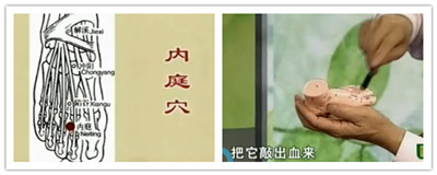 治療上牙齒疼痛的穴位：內(nèi)庭穴的位置圖