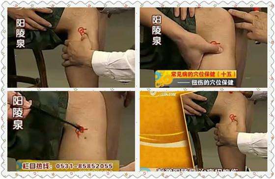 刺激陽(yáng)陵泉治療扭挫傷