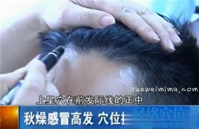 上星穴的位置圖