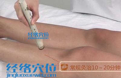 艾灸的方法：溫和灸的示范圖