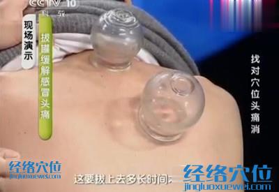 現(xiàn)場演示，拔罐大椎穴、肺俞穴治感冒頭痛